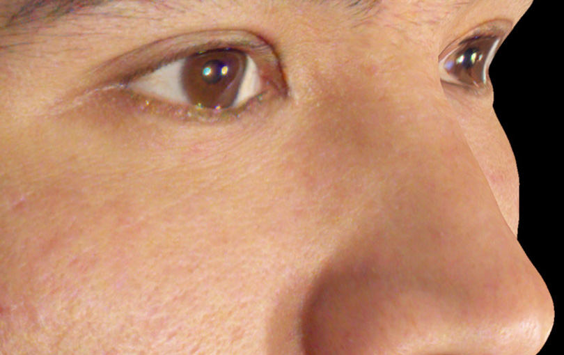 Original Image